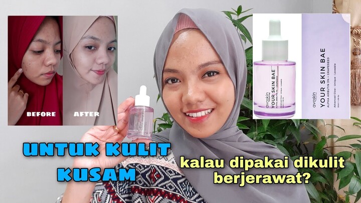 REVIEW AVOSKIN YOUR SKIN BAE alpha arbutin 3% + grapeseed | setelah pemakain 2 minggu