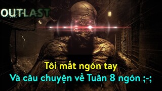 Tôi mất ngón tay và câu chuyện về Tuân 8 ngón | Outlast tập 2