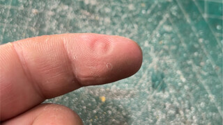 Thật là làm khó ngón tay của tôi quá đi!