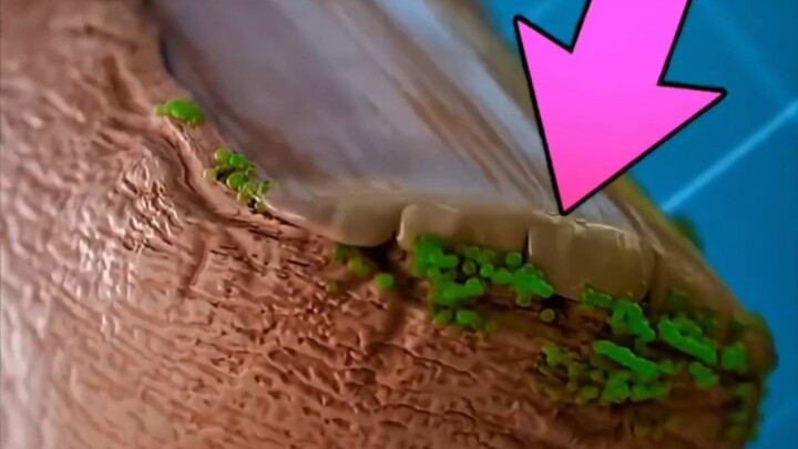 Quit biting your nails before it’s too late!