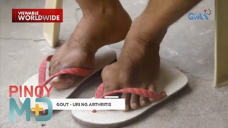 Paano maiiwasan ang sakit na gout? | Pinoy MD