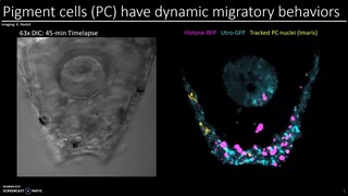 Sea Urchin Pigment Cell Time Lapse