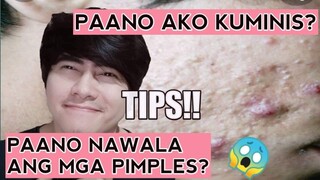 Paano ako kuminis at paano nawala ang mga pimples ko