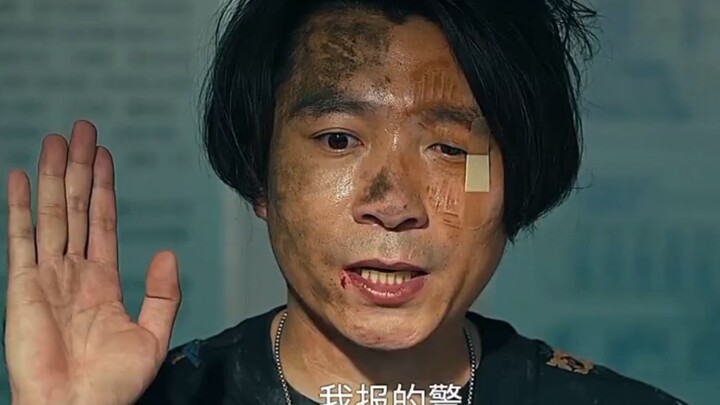 الضرر ضئيل، لكن الإهانة شديدة للغاية، والجملة الأخيرة مذهلة تمامًا.