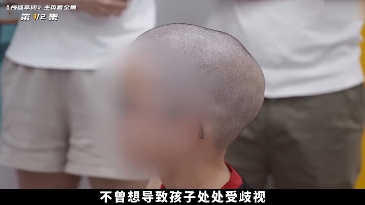 Having an irregularly shaped head is also a medical condition: doctors use a power saw to cut open t