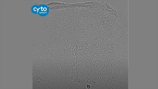 Time-lapse video of contracting primary corneal keratocytes