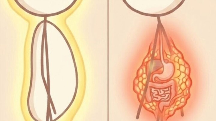 EP1 : ผอมแต่พุงป่อง อันตรายกว่าหี่ คิด! I Skinny Fat คืออะไร#Shorts