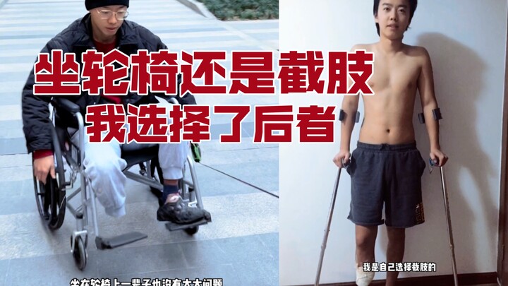 ประสบการณ์ของการตัดสินใจอย่างเด็ดขาดในการตัดขาคืออะไร?