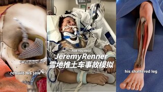 鹰眼Jeremy Renner2023年雪地推土车事故模拟