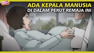 Jangan Sembarangan Terima Donor Ginjal - Pregnant Horror