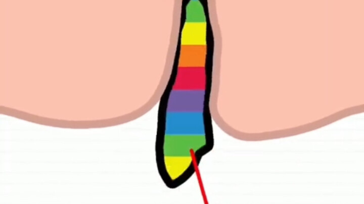 Permainan kecil yang melawan takdir 1618