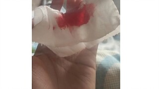 Đây là những gì virus corona mới giống như