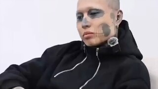 文面小伙透露洗纹身过程并不顺利，“洗右眼后视力下降了，皮肤像被灼烧。”称心脏病犯了中止清洗，诊所人员称至少清洗3次才能看不出。