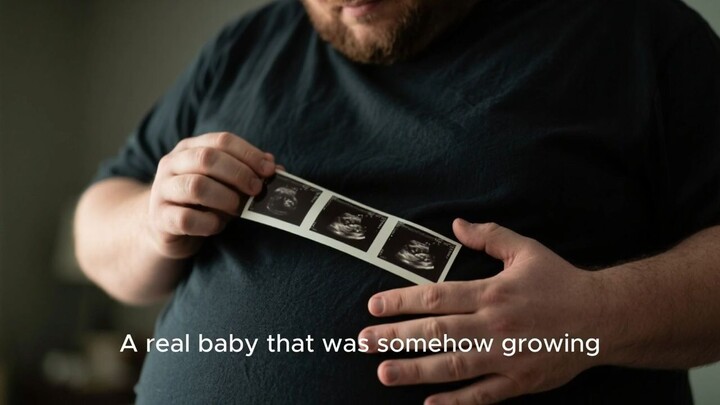 He Went for Weight Loss Surgery—But Found Out He Was Pregnant