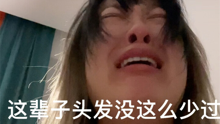 头发刚掉时的我VS现在的我