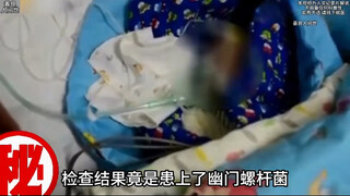 Grandma kissed her grandson and then developed a high fever