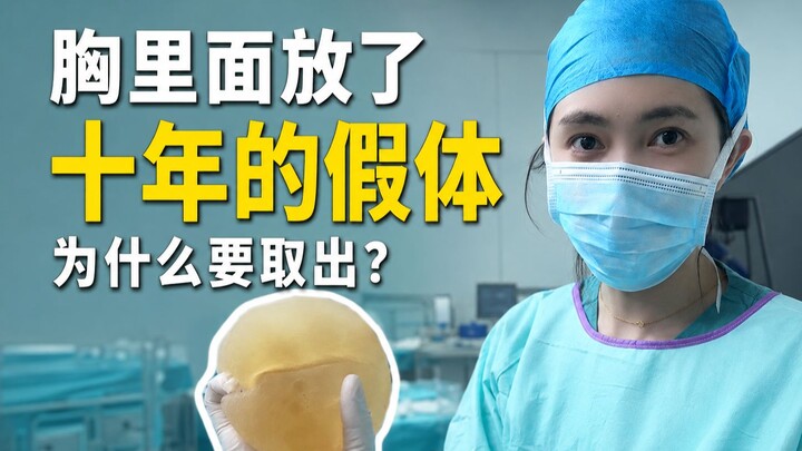 Why remove breast implants that have been in place for 10 years?