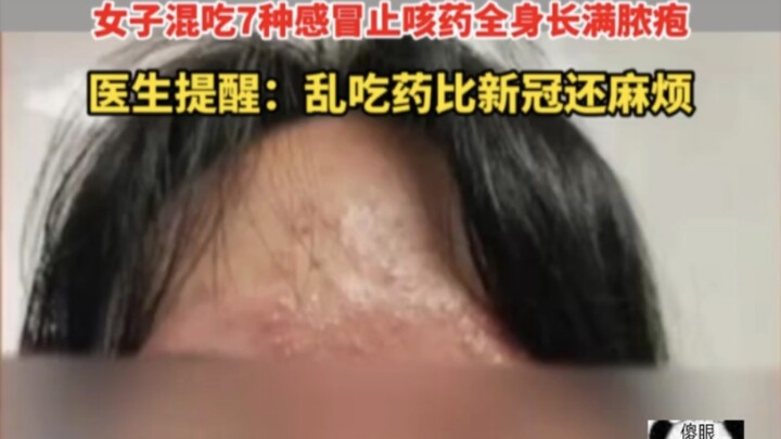 Konsumsi obat sembarangan lebih merepotkan daripada COVID-19! Seorang wanita mengonsumsi campuran 7 