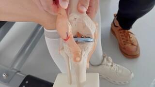 膝盖弹响无力千万别先去静蹲