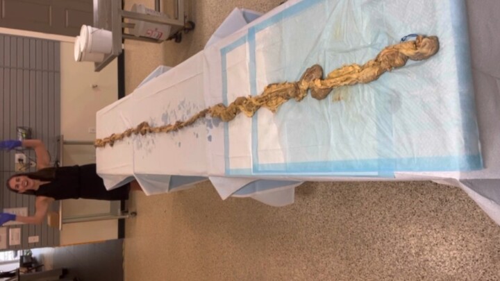 这长度，屎能拉出来还真不容易