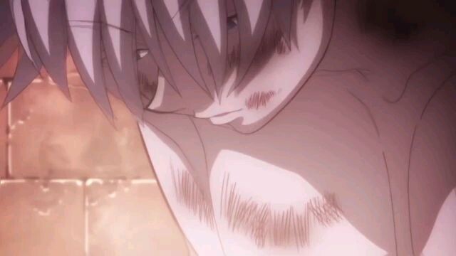 Killua Zoldyck [AMV] Thrift Shop (30 detik)