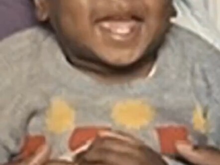 Harden’s Jaw-Dropping Facial Transformation From Young Star to Veteran