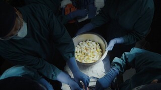 【良医】小伙腹痛入院，竟在肚中取出50多只毒包……《良医S3-11》