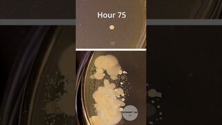 Washed vs dirty hands bacteria time lapse 🦠🧫 #bacteria #timelapse #shorts