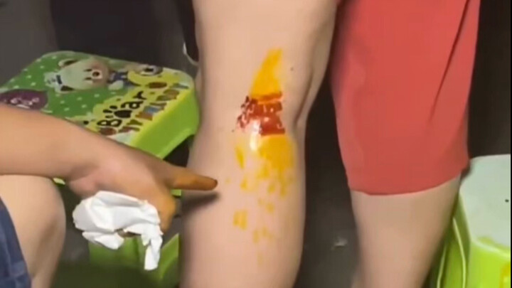 Unveiling Street Scams Involving Fake Medicinal Liquor: A Single Swipe on the Thigh Causes Bleeding!