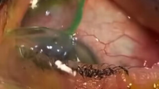 ما هذا يا رجل، أنت بارع حقًا في التخفي؟؟؟!!!