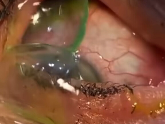 Dude, you're really good at hiding, huh???!!!