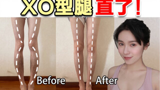 20年XO型腿还有救！超详细直腿教程 每天跟练 一个月肉眼见效果
