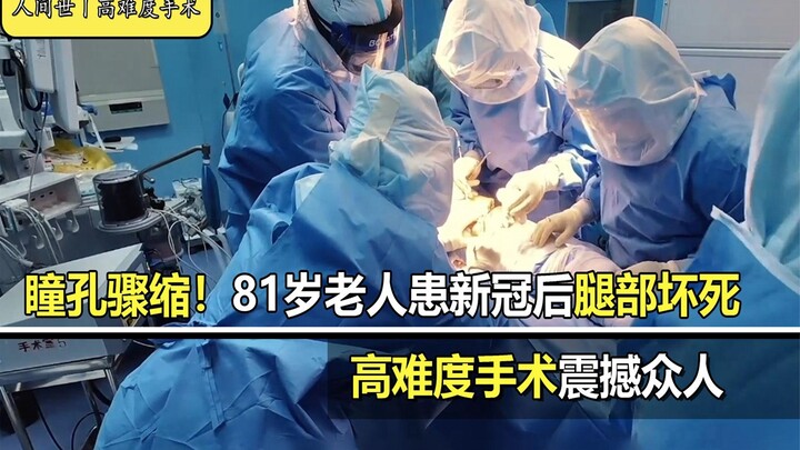 Documentary Commentary: Pupils Dilate Suddenly! 81-Year-Old Man Suffers Leg Necrosis After COVID-19 