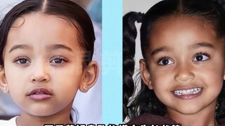 Analisis estetika Chicago, putri bungsu Kardashian, seperti apa rasanya memenangkan lotere genetik?