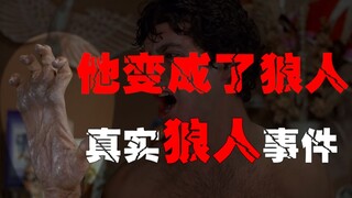 【เหตุการณ์มนุษย์หมาป่าจริง】มนุษย์หมาป่าเพียงหนึ่งเดียวแห่งศตวรรษที่ 20 พาคุณเข้าสู่โลกของมนุษย์หมาป่