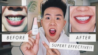 PANO PAPUTIIN ANG NGIPIN IN 30 MINS?! (My Teeth Whitening Secret!)