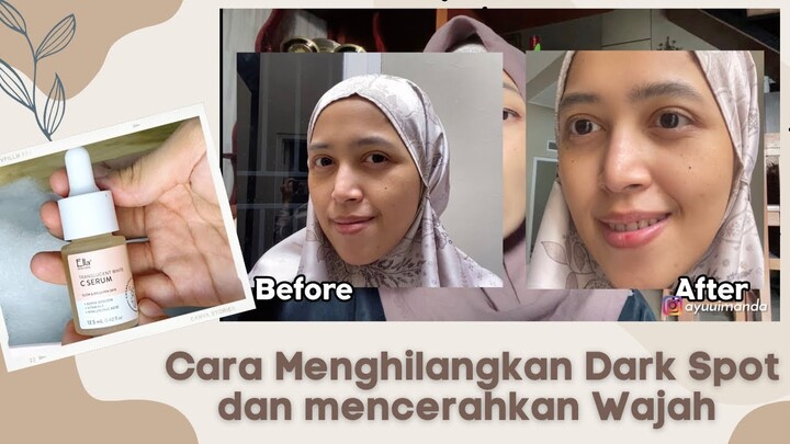 Tips Menghilangkan Flek Hitam & Dark Spot + Ella Skincare Translucent White C Serum Honest Review