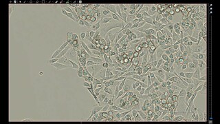 Time Lapse Imaging Living Cells