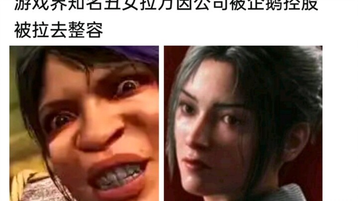 Tengzi’s plastic surgery is really working!