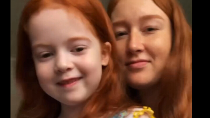 Where do you think most redheads live? No, not in the countries you're imagining.