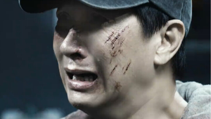 ศพน้องสาวขาดหัวใจ ชาวบ้านยากจนแม้แต่ศพยังไม่มีสิทธิ์รักษา!