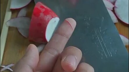 你知道*⃣️*⃣️多担心你吗