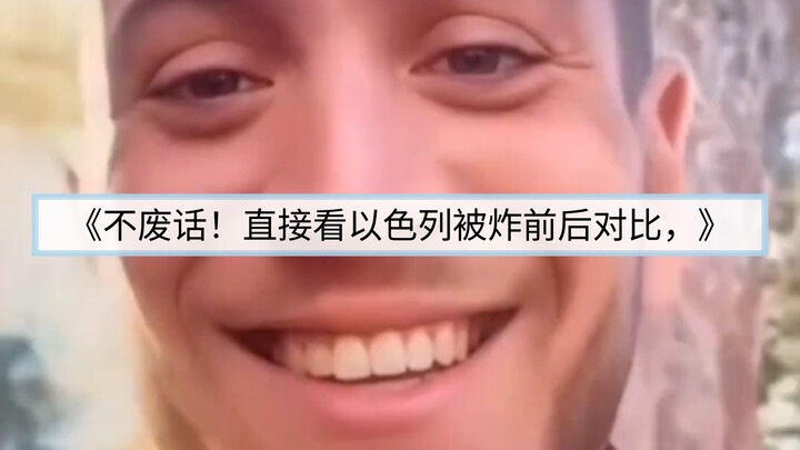 Perbandingan Warga Israel Sebelum dan Setelah Pemboman # “Detik Sebelumnya Masih Tertawa, Detik Beri