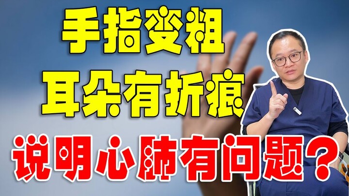 Nếu ngón tay và tai của bạn dài như thế này, nhất định phải cảnh giác!