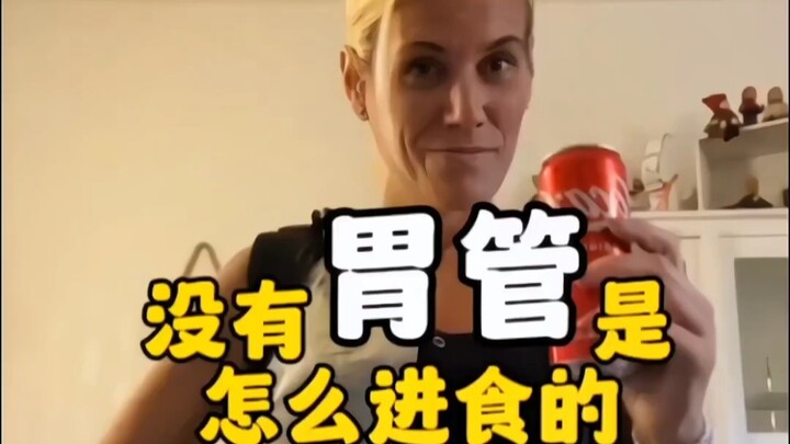 你知道没有胃管是怎么进食的的 怎么来获取自身需要的营养 #健康#知识#有趣
