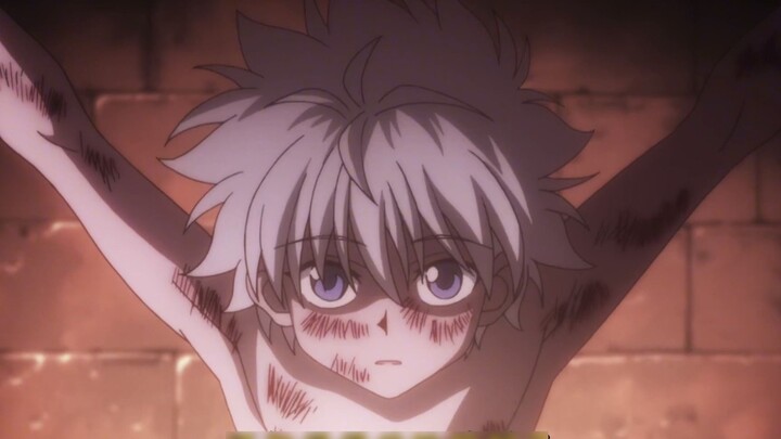 9_Hunter x Hunter Penuh Waktu: Betapa memberontaknya Killua? Dia menikam kakaknya dan menyayat wajah