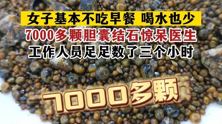 Woman Who Skips Breakfast and Drinks Little Water Develops 7,000 Kidney Stones