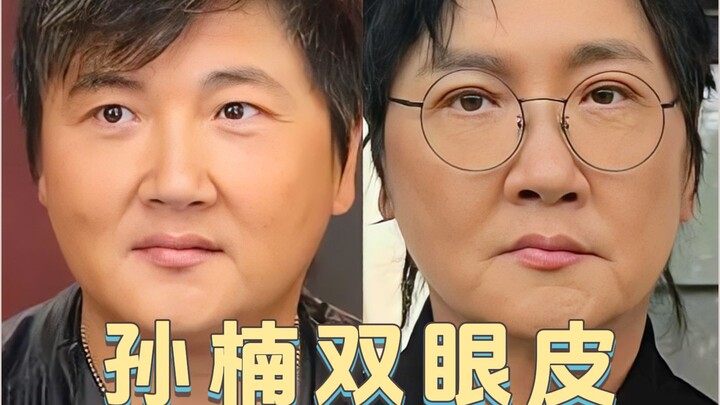 Đôi mắt hai mí của Tôn Nam cũng là dì