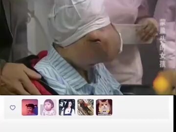 This surgery is so amazing!