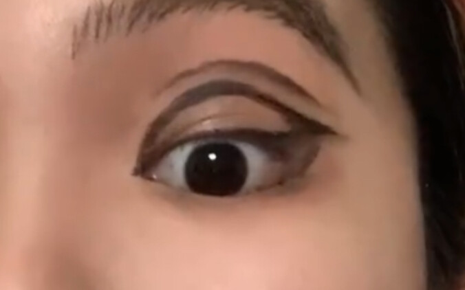 ตาสองชั้นแบบบวม…ใครเข้าใจบ้าง…จะบ้าตายแล้ว!